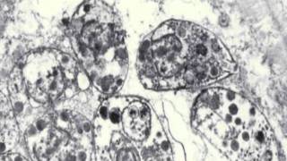 Toxoplasmosis amp Toxoplasma gondii [upl. by Adnohser307]