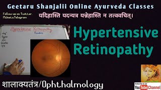 Hypertensive Retinopathy by Geetaru [upl. by Cherice873]