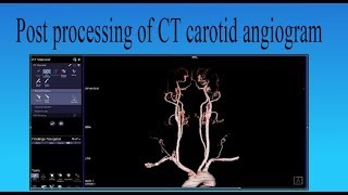 Anatomie im CT und MRT Schädel [upl. by Rollins]