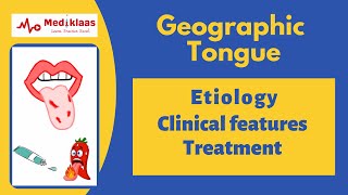 Geographic tongue Benign Migratory Glossitis [upl. by Ayekin]