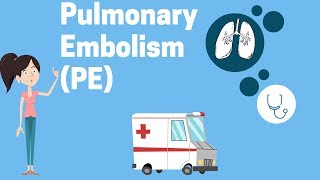 Pulmonary Embolism Remastered  Pathophysiology Symptoms Diagnosis DVT [upl. by Eednus]