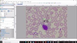 Conducting a Differential WBC Count with Human Blood [upl. by Kaja824]