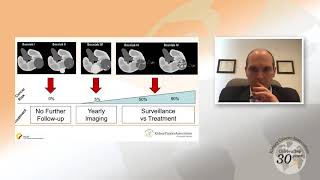 Small Renal Masses An Overview [upl. by Boorer238]