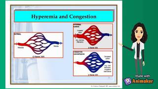 Hyperemia and Congestion  fluid and hemodynamics  pathology [upl. by Jasmina]