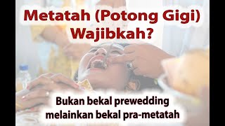 Potong Gigi Metatah itu wajibkah [upl. by Onitsirc]