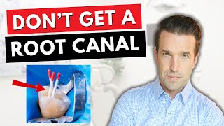 Dont get a ROOT CANAL before watching this [upl. by Ress]