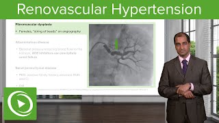 Renovascular Hypertension – Cardiovascular Pathology  Lecturio [upl. by Aeniah]