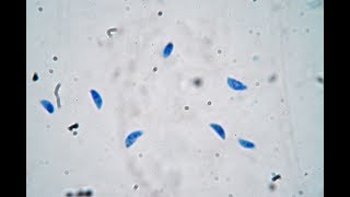 Toxoplasma gondii  live trophozoites [upl. by Atiuqaj]