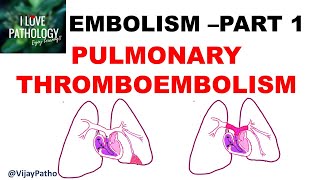 EMBOLISM Part 1 Pulmonary amp Systemic thromboembolism [upl. by Bourke765]