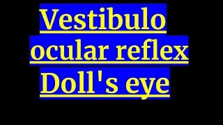 Vestibulo ocular reflex Dolls eye [upl. by Otila]