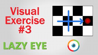 Lazy Eye Exercise 03 [upl. by Andromada]