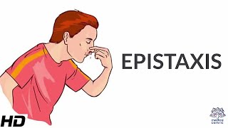 Epistaxis Causes SIgns and Symptoms Diagnosis and Treatment [upl. by Assetan]