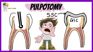 PEDIATRIC DENTISTRY  PULPOTOMY  Types Indications Procedure [upl. by Notserc658]