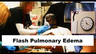 Flash Pulmonary Edema Emergency [upl. by Rance]