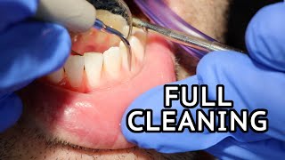 Why do childrens teeth fall out  Dr Raju Srinivas [upl. by Wichman]