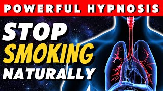 Stop Smoking Hypnosis Session Quit Smoking Naturally [upl. by Ahtiekal]